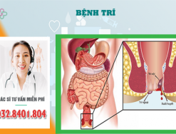 Bệnh trĩ độ 1 có cần phải phẫu thuật cắt trĩ?