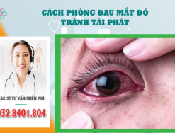 Cách phòng ngừa bệnh đau mắt đỏ tránh tái phát