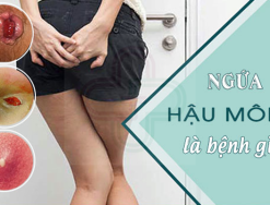 Giải đáp: Ngứa hậu môn là bệnh gì?