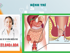 Phân biệt giữa bệnh trĩ và sa trực tràng cho đúng