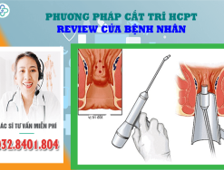 Review của bệnh nhân về phương pháp cắt trĩ HCPT