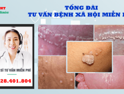 Tư vấn bệnh xã hội online miễn phí với bác sĩ chuyen khoa - 0328401804