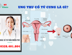 Ung thư cổ tử cung là gì: dấu hiệu và triệu chứng? [GIẢI ĐÁP]